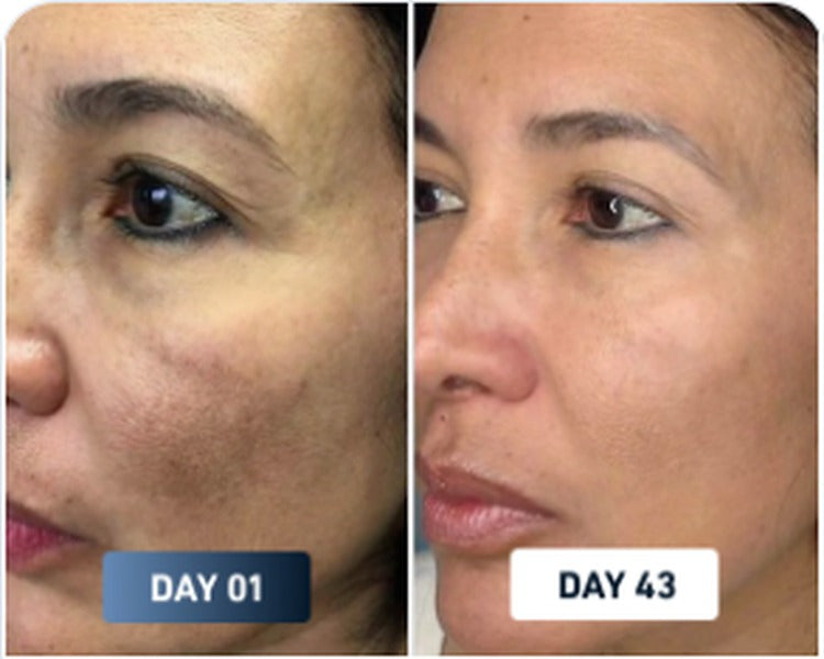 Dry skin before and after result 1