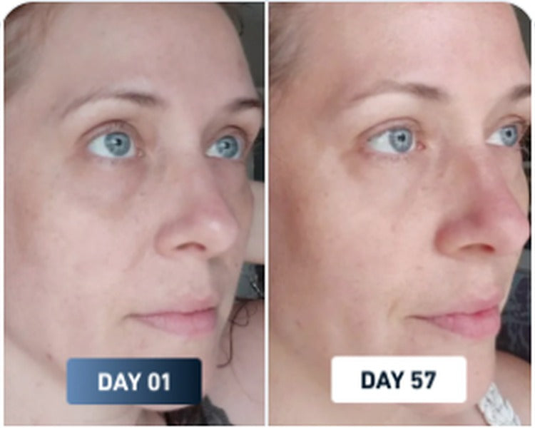 Dry skin before and after result 2