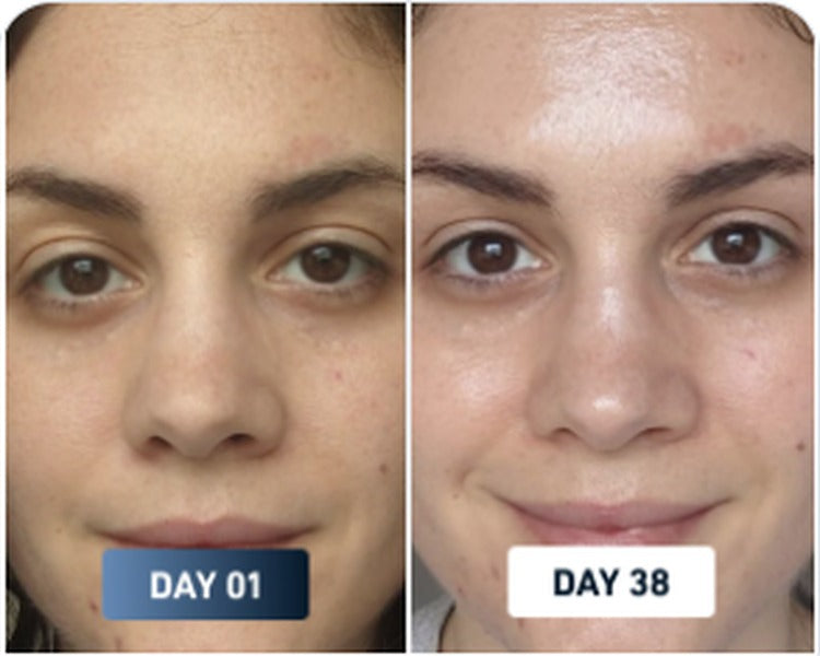 Dry skin before and after result 3