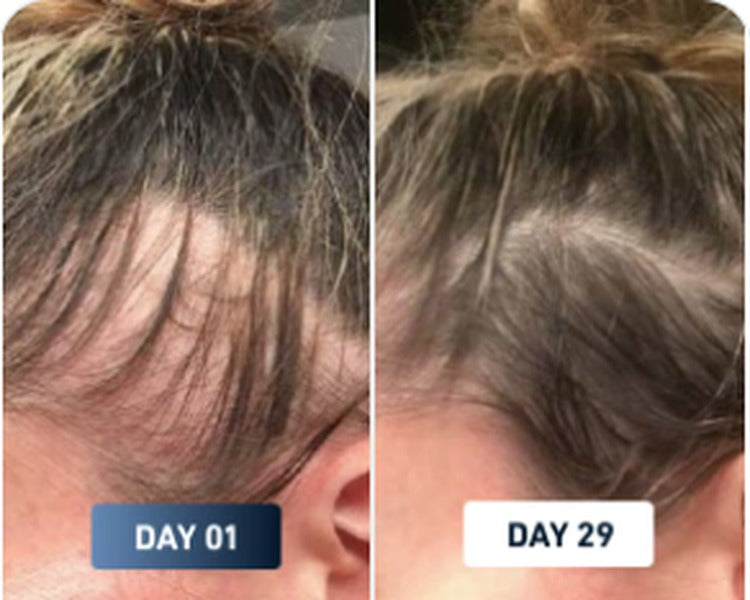 Hair shedding before and after result 1